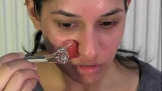 How to Use a Derma Roller for Acne Scars | Micro Needling