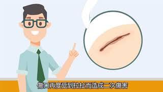 乾式療法 | 傷口達人保健室