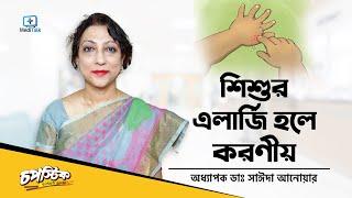 ছোটদের এলার্জির কারণ ও প্রতিকার । বাচ্চার এলার্জি থাকলে করণীয় । বাচ্চাদের ত্বকের অ্যালার্জির সমস্যা