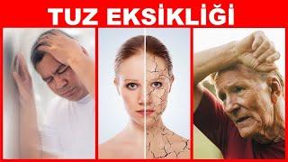 Tuz Eksikliğinin 7 Uyarı İşareti | Dr.Berg Türkçe