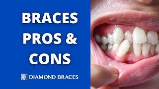 Pros and Cons of Braces