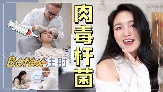 跟我一起去打肉毒杆菌 | 医美vlog | Botox去皱纹注射前后对比图