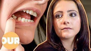 So Scared Of The Dentist My Teeth Are Falling Out | Our Life