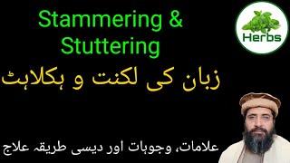 Stammering | Luknat ka Ilaj | زبان کی لکنت کا علاج | Hakeem Zia ur Rehman