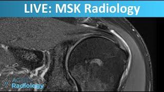 LIVE Stream: MSK Radiology Cases Ep.01