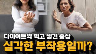 다이어트약 먹으면 겪는 부작용 모음 | 전남대학교병원 심장내과 이기홍, 김형윤 교수