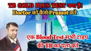 What is a TB Gold Plus test? TB Gold Plus टेस्ट क्या है? QuantiFERON-TB Gold Plus (QFT-Plus)