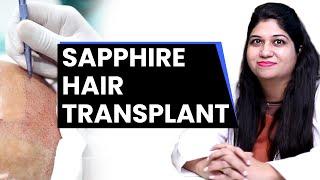  SAPPHIRE Hair Transplant 2022 | New Roots Hair Transplant |