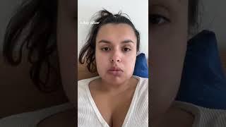 My Wisdom Teeth Recovery in 30 seconds | #wisdomteeth  #surgeryrecovery #dayinthelife