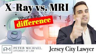 X-Ray vs. MRI EXPLAINED!! New Jersey Lawyer Peter Michael