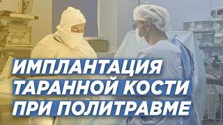 ЗАМЕНА ТАРАННОЙ КОСТИ: многоэтапный подход к лечению. ДОКТОР ТРАВМАТОЛОГ-ОРТОПЕД ИГОРЬ ПАХОМОВ.