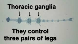 Isolation of the central nervous system from a cockroach nymph