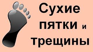 Очень сухая кожа стоп? Есть простое и эффективное лечение сухих пяток и стоп в домашних условиях.