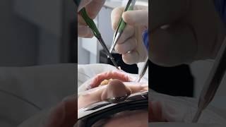 Одиночная имплантация / Стоматология как искусство.