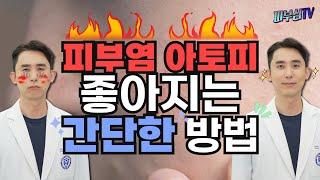 피부염 아토피 좋아지는 가장 간단한 방법! [피부과전문의 피부심]