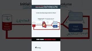 Understanding Hypovolemic Shock | For Nursing Students