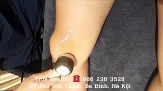 Bấm huyệt trị liệu đau khớp gối