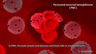 Hemolytic processes in PNH and its treatment: intravascular and extravascular hemolysis