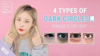 How to Remove Dark Circles Under Eyes In The Most Effective Way! | Teen Beauty Bible