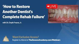 Dawson Academy: How to Restore Another Dentist’s Complete Rehab Failure