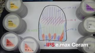 Education Video: Pheng Lor-Showcasing the Ivocolor technique