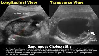 Abdominal Ultrasound Reporting | Liver, Gallbladder, Bile Duct, Pancreas, Spleen, Kidney USG Reports