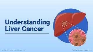 Understanding Liver Cancer