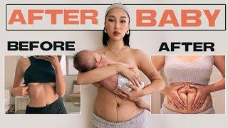 THIS IS MY POSTPARTUM BODY  | Boob Job After Baby, Postpartum Depression...