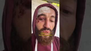 Избитый сослуживцами осетин понял что воюет не с теми фашистами #нетвойне #россия #украина