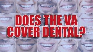 Does The VA Cover Dental?