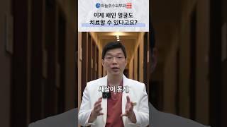 얼굴이 패여있는 것도 해결이 된다고요? #패인피부#여드름흉터#큐어젯#피부과