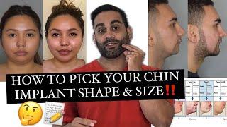 Chin Implant (what size & shape is best for YOU)