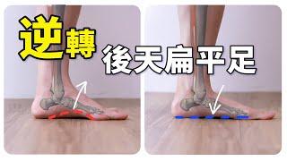 No More Painful Feet While Shopping: Say Goodbye to Tibialis Posterior Tendonitis