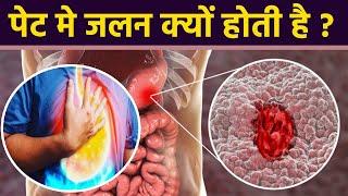 पेट में जलन क्यों होती है । पेट में जलन का कारण । Boldsky *Health