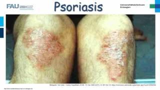 Dermatologie ─ Psoriasis