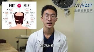 植髮FUE、FUT原理大不同：MyHair林哲佑醫師針對禿頭植髮前的三大建議