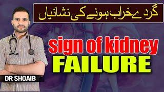 Kidney Failure K Signs and Treatment In Urdu/Hindi By Dr Shoaib