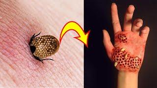 12 Most Dangerous Bugs in the World