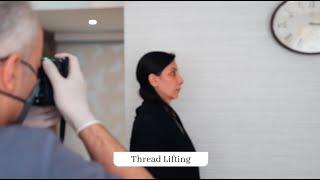 Thread Lifting at Dr. Kayle Aesthetic Clinic | Dubai, UAE
