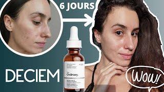 JE TESTE LE NOUVEAU SÉRUM À L'ACIDE SALICYLIQUE DE THE ORDINARY? COMMENT L'UTILISER? A QUOI SERT-IL?