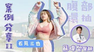 【腹部環抽】VLOG全紀錄！真實抽脂案例(上)－蘇瑋智醫師.Feat.石見三也