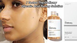 I Tested The Ordinary Glycolic Acid Toner Every Day For A Week & This Happened