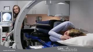 Vertebral Motion Analysis for testing lumbar spine motion at Spine Nevada, Reno, Sparks, Carson