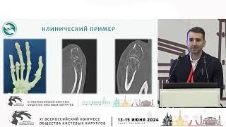 Гамидов Ф.М.: применение 3D технологий в хирургииверхней конечности.