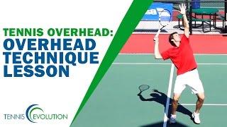 TENNIS OVERHEAD | Overhead Technique Lesson