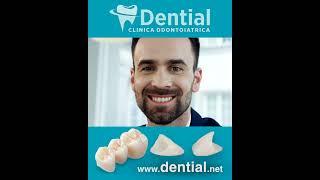 Dentista Albania | Dential clinica odontoiatrica