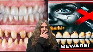 "Exposing Veneer Tech Scams: The Hidden Dangers of Fake Dental Work" Blagg Tv REACTS￼