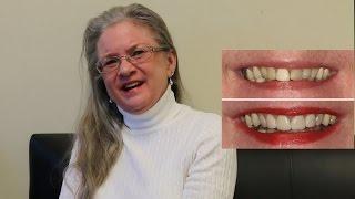 Christie's Smile Transformation Testimonial | Calcaterra Family Dentistry