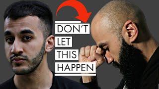 HAIR LOSS & SOCIAL ANXIETY - How To Confront The Anxiety Of BALDING Young - Balding Advice
