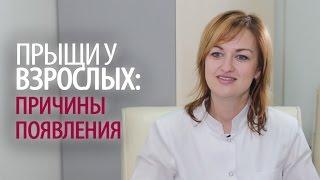 Прыщи у взрослых: причины появления акне